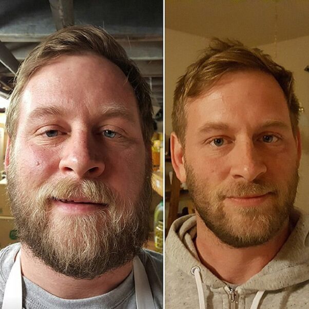 das Aussehen der Person vor und nach dem Aufgeben des Alkohols